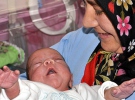 Yaşama azmiyle görenleri şaşırttı