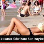 turkiye-nin-bacasiz-fabrikasi-kan-kaybediyor_x_7821496_4291_z1[1]